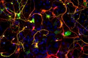 Transforman por primera vez astrocitos en neuronas específicas para reparar circuitos visuales