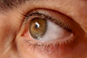 Unos 111.000 valencianos padecen glaucoma y la mitad no lo saben