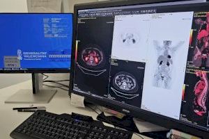 El Hospital Clínico licita la adquisición de diez estaciones de trabajo para la lectura de pruebas radiológicas