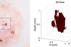 El I3M obtiene las primeras imágenes en 3D de un melanoma en ratones con un microscopio fotoacústico de bajo coste