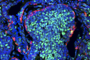 Un estudio del Instituto de Neurociencias UMH-CSIC revela que las células cancerosas compiten a favor y en contra del desarrollo del tumor